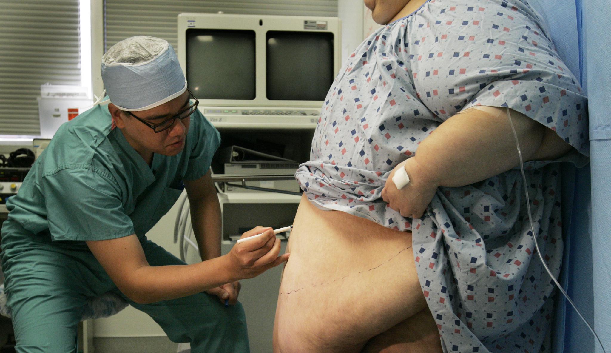 Weight-loss surgery should be an option for more patients, research says